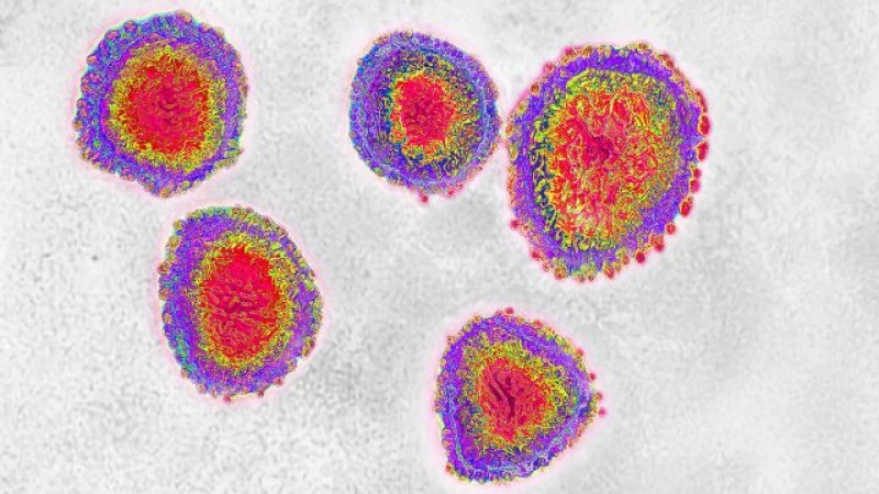 Coronavirus llega a América: Estados Unidos registra el primer infectado